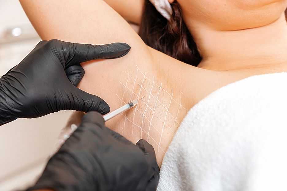 Procedure of injecting treatment into armpit with black gloves and marking grid lines.
